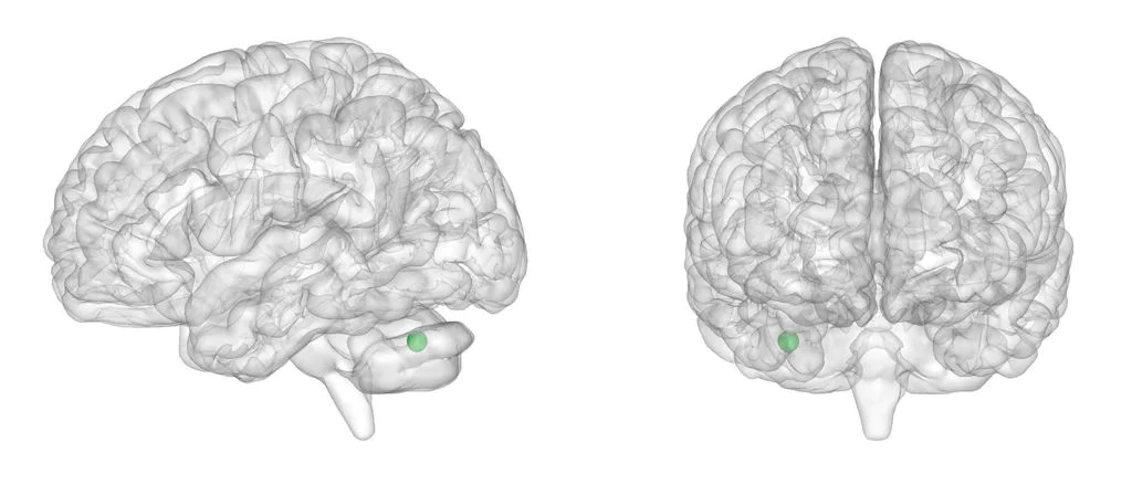 Representació del pic negatiu significatiu al cerebel dret